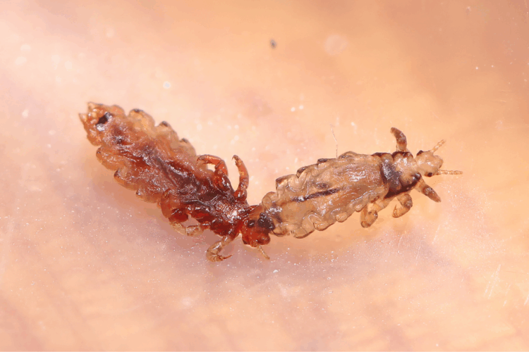 Pidocchi sui capelli: come riconoscerli subito ed evitare il contagio